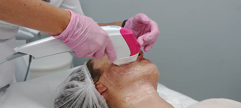 Сочетаемые методики: микроигольчатый RF-лифтинг Vivace и биорепарация, Ultraformer MPT4 и коллагеностимуляция